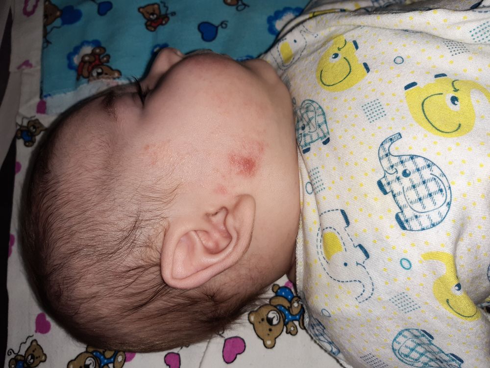 reshenie problem allergicheskie reaktsii i drugie slozhnosti pri kupanii